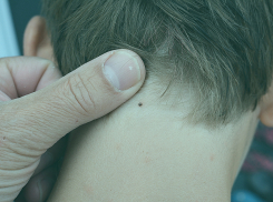 С начала сезона почти 2 тысячи тамбовчан укусили клещи 