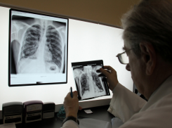 В Тамбовской области увеличилась заболеваемость туберкулёзом