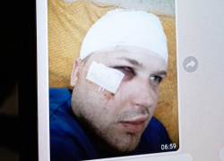 Тамбовского собаколова избили в Липецке