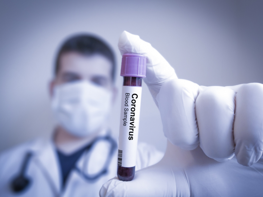 В Тамбовской области обследовано почти 15 тысяч человек на наличие коронавируса