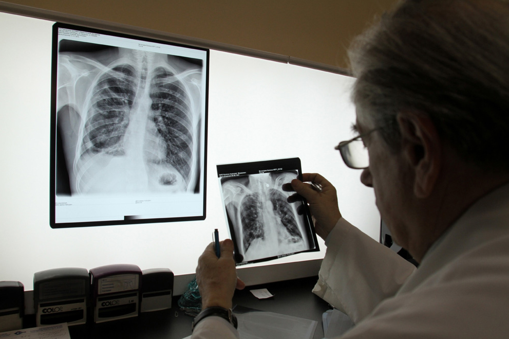 В Тамбовской области увеличилась заболеваемость туберкулёзом
